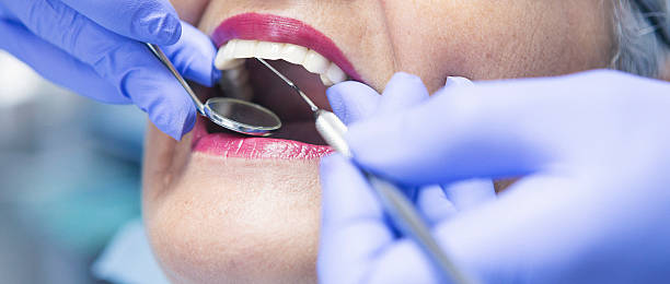 Best Emergency Wisdom Teeth Removal in Old Brookville, NY
